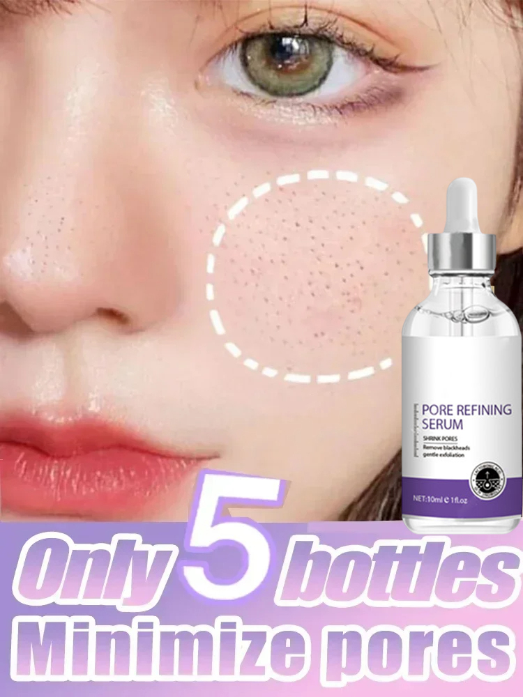 3차 피부 질감 |   모공 개선, 피부 재생 및 브라 - Milk Thistle Silymarin 리뷰 및 가격